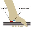 Vereinfachte Darstellung der Funktion der BioXCell-Kissen